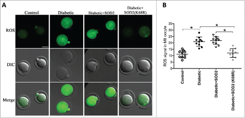 Figure 5. SOD2K68R partly prevents oxidative stress in oocytes from diabetic mice. SOD2 WT or SOD2K68R mutant mRNA was microinjected into fully-grown GV oocytes from diabetic mice, which were arrested at GV stage in M16 medium containing 2.5 μΜ milrinone for 20 hours to allow synthesis of new protein. Following in vitro-maturation, MII oocytes were stained with CM-H2DCFAD (green) to evaluate ROS levels. (A) Representative images of CM-H2DCFAD fluorescence in control, diabetic, diabetic+SOD2 and diabetic+SOD2 (K68R) oocytes. Scale bar: 25 μm. (B) Quantitative analysis of fluorescence intensity shown in A (n = 10 oocytes for each group). Data were expressed as mean ± SD from 3 independent experiments. *p < 0.05 vs control.