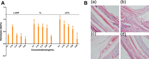 Figure 9 (A) The hemolytic rate of red blood cells after incubation with different concentration of L-OHP, TL, LCTL formulations. (B) The irritation to the vessels after the administration of saline (a), L-OHP solution (b), TL (c) and LCTL (d).