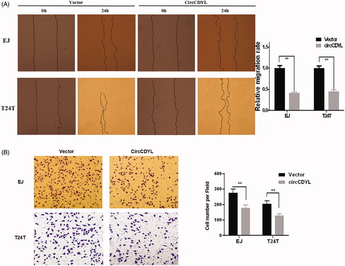 Figure 4. Over-expression of circCDYL inhibits cell migration in bladder cancer cell lines. (A) In wound healing assay, the migration of EJ and T24T cells transfected with circCDYL were significantly decreased. Data are mean ± SEM, n = 3. **p < .05 (Student’s t-test). Scale bar: 200 μm. (B) Transwell migration assays demonstrated that circCDYL decreased the invasion ability of EJ and T24T cells. Data are mean ± SEM, n = 3. **p < .05 (Student’s t-test). Scale bar: 100 μm.