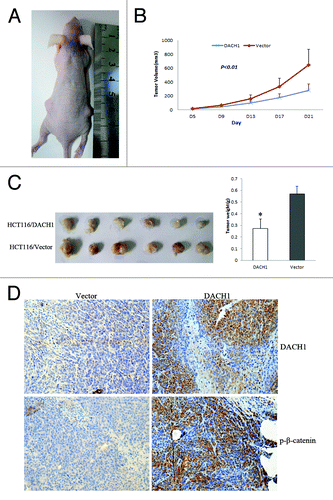 Figure 6. DACH1 retarded tumor growth in vivo. (A) Representative picture of tumor growth in nude mice subcutaneously inoculated with DACH1 expressing vector (right) and empty vector (left). (B) Subcutaneous tumor growth curve in xenograft mice with or without DACH1 expression. Retarded tumor growth was found in DACH1-expressing group. (C) Histogram represents average weight of xenograft in DACH1-expressing and DACH1-non-expressing groups. (D) Increased p-β-catenin was found in DACH1-expressing xenografts by IHC staining (x400).