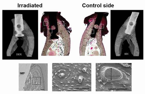 Figure 2. The histological sections and their corresponding micro-CT images for the implants placed in the irradiated and non-irradiated mandible of a dog. For the measurements with SEM, the alveolar process of mandible was divided into three main regions of interest (ROIs): lateral areas, one buccally and one lingually, and one attached to implant. SEM images represents methods and the results are presented in Table 2. (Bars = 100 µm)