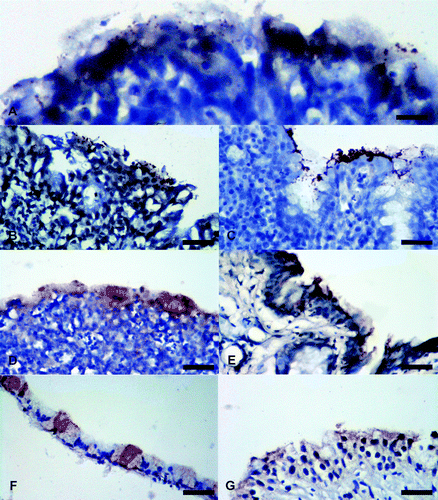 Figure 1.  Photomicrographs of IHC staining for M. gallisepticum antigens in tissues from experimentally infected chickens, sparrows, and pigeons. Brown stain indicates presence of M. gallisepticum antigens. Tissues are counterstained using haematoxylin (blue). 1a: Moderate staining (++ ) in a chicken's conjunctiva. 1b: Moderate staining (++) in a chicken's nasal cavity. 1c: Intense staining (+++) in a chicken's trachea. 1d: Moderate staining (++) in a chicken's air sac. 1e: Moderate staining (++) in a sparrow's conjunctiva. 1f: Mild staining (+) in a sparrow's trachea. 1g: Mild staining (+) in a pigeon's conjunctiva. All scale bars = 50 µm.