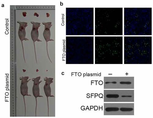 Figure 4. Over-expression of FTO could inhibit the growth of BC cells in vivo A. tumor xenograft mouse model showed that the tumor volume was significantly reduced in mice treated with FTO plasmid. B. tunel was used to determine cell apoptosis, showed that FTO plasmid enhanced cell apoptosis. C. western blot analyzed the expression of FTO and SFPQ