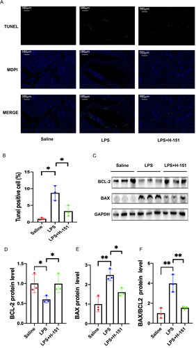 Figure 6. H151 alleviated apoptosis of renal tubular cells induced by LPS. (A) Representative images of TUNEL. Scale bars = 100 μm. (B) Quantification of TUNEL-positive cells (n = 3). (C) Representative blots of BAX and BCL-2. (D–F) Relative densitometry of BAX, BCL-2, and BAX/BCL-2 normalized to GAPDH (n =3). *p < .05 and **p < .01.