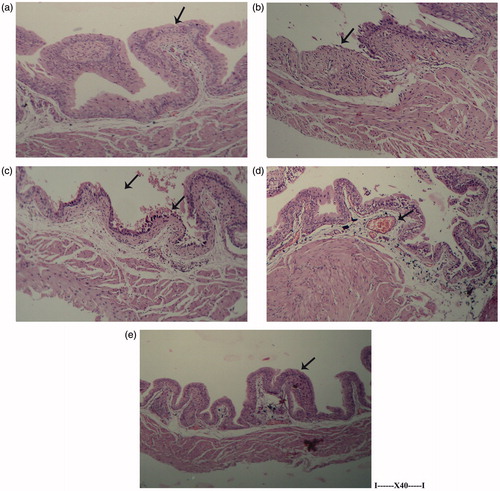 Figure 6. Histology of the urinary bladder due to treatments. A representative micrograph from a mouse in each regimen is shown. (a) Naïve control showing normal epithelium. (b) CTX only (25 mg/kg BW) showing damaged epithelium with edematous area. (c) A. ferruginea extract (10 mg/kg BW) + CTX showing normal lamina propria. (d) MESNA (25 mg/kg BW) + CTX showing normal mucosa. (e) Extract only showing normal architecture. All treatments were by IP injection of each treatment agent daily for 10 consecutive days. In all cases, the volume of any missing component for a given Group was replaced by phosphate buffer saline such that all mice received the same volume of injection each day. Magnification = 40×.