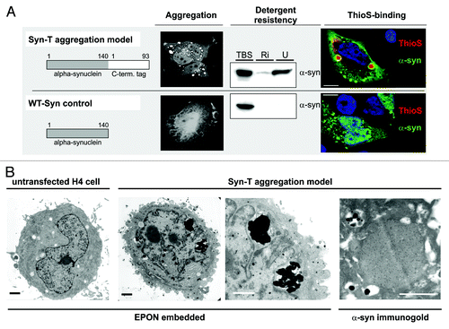 Figure 2. SynT-aggregation model and WT-Syn control. (A) Transient co-transfection of H4 neuroglioma cells with an 93 aa long C-terminal tag fused to α-synuclein (SynT) co-expressed with synphilin-1 resulted in larger intracellular α-synuclein aggregation.Citation15,Citation24 Immunostaining for α-synuclein revealed several aggregates of 2–5 µm diameter that were resistant to RIPA (Ri) and urea (U) extractions and ThioS-positive. Smaller aggregates (< 2 µm) were ThioS negative. Transfection with untagged human WT α-synuclein (WT-Syn) did not result in larger α-synuclein immunopositive aggregates and was found only in the TBS-soluble fraction 24 h after transfection. Electron microscopy of untransfected (1st image) or SynT/Synphilin1 transfected H4 neuroglioma cells (2nd–4th image, B) revealed electrodense structures (2nd image and higher magnification in 3rd image) in transfected cells only, that were associated with vesicular structures which resemble autophagic vesicles. Aggregates were α-synuclein positive (immunogold-labeling for α-synuclein, 4th image). Scale bar: 1 µm.