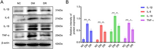 Figure 8. RSV reduces the expression of pro-inflammatory cytokines in DW tissues. (A) WB analysis of pro-inflammatory cytokines. (B) WB statistical plot. WB: western blot. *p < .05 vs. DM. **p < .01 vs. DM. ***p < .001 vs. DM.