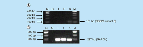 Figure 12. (A & B) Expression analysis of RBBP6 variant 3 in untreated MCF-7, Caski and Hek-293 cells.Amplification of RBBP6 variant 3 in MCF-7 cells, Caski cells and Hek 293 cells. The result (A) shows untreated MCF-7 cells (lane 1) and untreated Caski cells (lane 2) both with an undetectable expression of RBBP6 variant 3, only untreated Hek 293 cells (lane 3) show the expression of RBBP6 variant 3. (B) (Lanes 1–3) represent GAPDH that was used as a loading control. Lanes M stand for the molecular weight marker while lanes BL were blank controls.