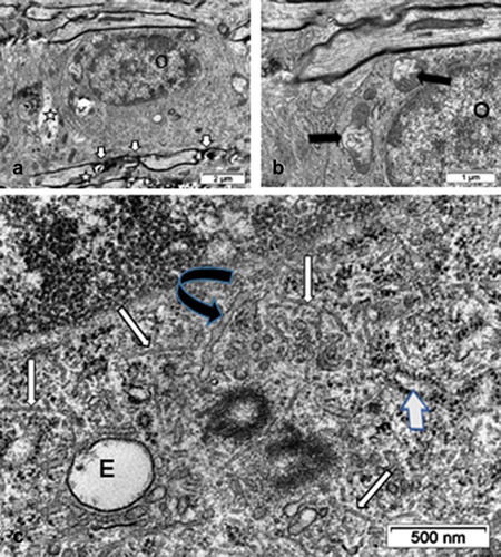Figure 13. Views of fine structures in one interfibrillar ODS 48h oligodendrocyte surrounded, in A, by bundles of axons where myelin juxtanodal zones still showed damages (small white arrows) and axons profiles with swollen content (star). In A and B: mitochondria still reveal swollen parts (black arrows). C: Enlarged perikaryon region decorated by innumerable ribosomal particles containing numerous organelles: a large endosome (E) and two obvious centriolar bodies are surrounded by numerous small coated vesicles and numerous haphazardly distributed, bended microtubule segments (white arrows). A black curved arrow marks a long winding RER cistern as an extension of the nuclear envelope