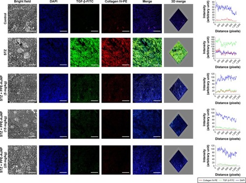 Figure 7 Immunofluorescence images demonstrating the expression of TGF-β and collagen IV. Slides were viewed using a confocal microscope (magnification 20×). Respective fluorescence intensities (TGF-β-FITC, collagen IV-PE, and DAPI) were analyzed using ImageJ software through RGB calculator.Abbreviations: PE, phycoerythrin; PPE-AuNP, pomegranate peel extract-stabilized gold nanoparticle; RGB, red-green-blue; STZ, streptozotocin; TGF-β, transforming growth factor β.