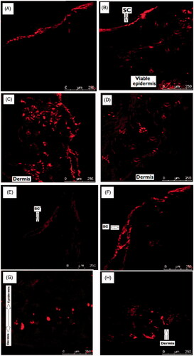 Figure 10. CLSM images of rat and human skin: (A) Control rat skin treated with fluorescence labelled patch containing free rutin F1; (B–D) Rat skin treated with fluorescence labelled RNP containing patch F2; (E) Control human skin treated with fluorescence labelled patch containing free rutin F1; (F–H) Human skin treated with fluorescence labelled RNP containing patch F2. Fluorescent probe (RhB) loaded patches were applied to dorsal skin area of the rats and human cadaver skin for 24 h. The exposed skin area was excised, washed with distilled water, frozen overnight in liquid nitrogen at −196 °C and skin samples were sectioned in a SHANDON CRYOTOME E (Thermo Electron Corporation, Waltham, MA, USA). Skin sections were examined in a Leica DMi8 confocal laser scanning microscope (Leica, Heidelberg, Germany) with optical excitation of argon laser beam at 520 nm and fluorescence emission of RhB at above 580 nm. Skin sections were imaged under 20× objective in the x-y axis to find the penetration depth and deposition of the RhB-loaded RNPs in the whole thickness of the skin.