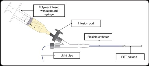 Figure 2 Schematic representation of the Photodynamic Bone Stabilization System.