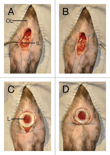 Figure 4. Purse-string suture fixes the AIW into the animal. (A) A purse-string suture is placed. The suture is first placed through skin and then through opposing abdominal wall. The outer loops (OL) are not tightened, whereas the inner loops (IL) are. (B) Once the purse-string suture is placed it should contain 4 or 5 outer loops. (C) The AIW is glued to the organ (liver [L]) and the skin and abdominal wall are placed within the window groove. (D) The sutures are tightened to secure the AIW in place. All pictures adapted fromCitation31 by permission from Macmillan Publishers Ltd: Nature Protocols.