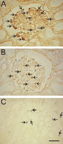 Figure 3. Identification of trypan blue-labeled podocytes and peritubular endothelial cells. Kidneys were stored for 48 h in UW solution, reperfused with KHB buffer containing trypan blue, and prepared for immunocytochemistry, as described in MATERIALS AND METHODS. A: A section was stained with primary antibody against ezrin, a podocyte marker. Trypan blue-labeled nuclei in the glomerulus displayed brown staining for ezrin (arrows). B: The section was stained with primary antibody against desmin, a glomerular mesangial cell marker. Desmin-positive cells (arrows) did not label with trypan blue. C: The section was stained with primary antibody against Factor VIII, a vascular endothelial cell marker. Brown staining for Factor VIII (arrows) coincided with trypan blue labeling of medullary peritubular cells. Scale bar is 50 µm. (See color insert at end of issue.)