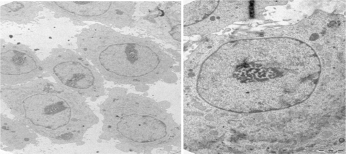 Figure 6 Transmission electron micrographs of 5RP7 cells not treated with folic acid-modified magnetic nanoparticles. C) 4200×; D) 8200×.