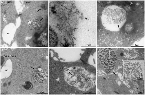 Figure 4. TEM imaging of HepaRG cells exposed to 16 µg/cm² for 6 h to (A) pristine M-MSNs, (B) PEG M-MSNs, (C) DMPC M-MSNs, and for 24 h to (D) pristine M-MSNs, (E) PEG M-MSNs, (F) DMPC M-MSNs. N indicates the nucleus, BC indicates bile canaliculi, and arrows indicate NPs.