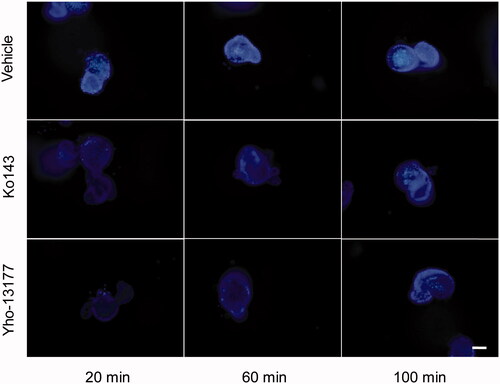 Figure 5. Fluorescent substrates accumulate in the organoids. The organoids were incubated in Hoechst 33342 with or without YHO-13177 or Ko143 for 20, 60 and 100 minutes, respectively. Ko143 and YHO-13177 notably decreased the fluorescence intensity of Hoechst 33342 in the organoids. Scale bar: 50 µm.