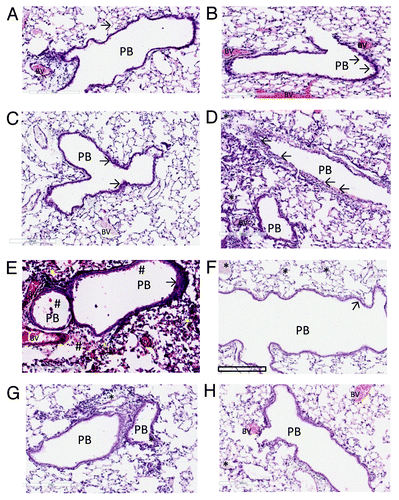 Figure 4. The histopathology of the lungs of Balb C mice immunised against Kat A/Ad, after acute exacerbation of chronic infection by P. aeruginosa. Immunised mice lungs showed reduced cellular recruitment, infiltration and lung consolidation and damage after the acute bacterial challenge compared with lungs from non-immunised, chronically infected control mice. (A) Shows the histological features of the lung in naïve mice, prior to chronic infection. Pulmonary bronchioles (PB) exhibit regular, intact epithelial surface and the epithelial walls of the alveolus (arrowed) encompass well defined expanded chambers, free of mucus. BV, blood vessel. (B) Illustrates the increased epithelial thickness (arrowed) and infiltration of nucleated cells adjacent to the alveoli resulting from establishment of chronic infection, within the mouse lungs prior to immunisation. (C) Illustrates similar characteristics resulting from the establishment of chronic infection in the lung in non-immunised mice, prior to bacterial challenge. As observed in (B), chronic infection has increased epithelial thickness (arrowed). (D) Shows the features of lung histology from chronically infected mice after immunisation against Kat A/Ad, prior to acute bacterial challenge. Although increased epithelial thickness is observed in the PB and there is evidence of localized cellular recruitment, the airways remain clear. (E) Demonstrates the damage induced in lung morphology from chronically infected mice in the absence of immunisation to Kat A/Ad, four hours after acute bacterial challenge. PB epithelia are thickened, alveolar walls and capillaries compromised leading to extravasation of blood into airways (#), increased cellular recruitment and consolidation of the lung through collapse of alveolar structure. (F) Demonstrates, in comparison to (E), that 4 h post bacterial challenge, the lung morphology of mice immunised against Kat A/Ad does not exhibit the epithelial damage, alveolar destruction, cellular recruitment or leakage of blood into the airways seen in non-immunised animals. The airways remain relatively clear, with minimal epithelial thickening (arrow). There is some evidence of increased mucus secretion (*) in smaller airways that have retained the mucus during histological processing of the lung. (G and H) Illustrates the lung histology, 24 h post bacterial challenge in non-immunised (G) and animals immunised against Kat A/Ad. In both groups, clearance of the acute damage observed in (E and F), has occurred, however the epithelial thickening, cellular infiltration and alveolar damage is more extensive in the lungs from non-immunised mice. Immunised mice still retain mucus within some of the airways however the extent of airway damage and consolidation appears less in this group.