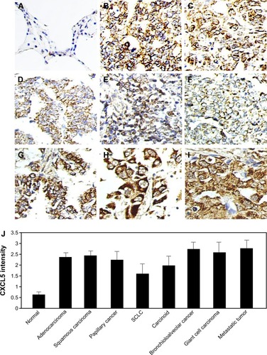 Figure 1 Representative images of CXCL5 expression by immunohistochemical staining.