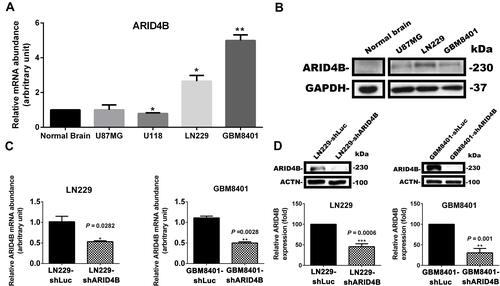 Figure 2 ARID4B expression in gliomas and establishment of ARID4B knockdown glioma cells. (A) Levels of ARID4B expression in gliomas determined with RT-qPCR. *P < 0.05, **P < 0.01 vs the control shLuc group (B) Western blots showing ARID4B expression in gliomas. ARID4B knockdown using shARID4B in LN229 and GBM8401 validated by (C) RT-qPCR and (D) Western blotting. *P < 0.05, **P < 0.01, ***P < 0.001 vs the control shLuc group.