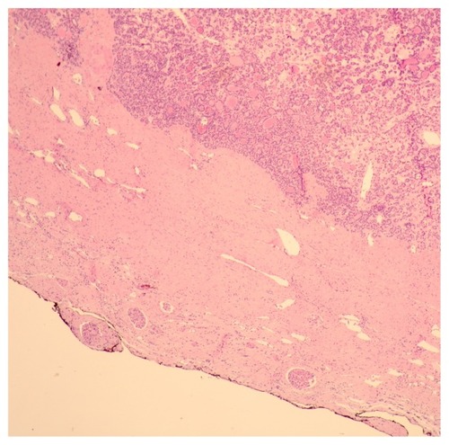 Figure 4 Histological findings.