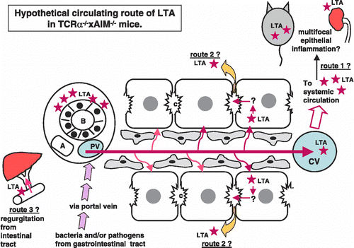 Figure 4 Hypothetical circulating route of LTA in TCRα− / − × AIM− / − mice. At first, bacteria and/or pathogens including LTA were taken from the epithelia of the gastrointestinal tract. LTA and/or bacterial components, as well as other pathogens, reached the liver via portal blood flow. These LTA and/or LTA-containing materials would be drained toward the central vein in the liver. LTA immunoreactivities were detectable not only in the liver and gastrointestinal tract, but also in the pancreas, kidney, and spleen. Via systemic blood flow, LTA could be trapped in other organs, which might possess a higher affinity to LTA (speculative route 1). LTA was also detected within the cytoplasm of hepatocytes. Perhaps LTA that escaped to be phagocitized by Kupffer cells is taken into hepatocytes via sinusoidal blood flow from the space of Disse (speculative route 2). There are three possible explanations for how LTA accumulates around the interlobular bile duct. One speculation is that from the hepatocytes, via bile canaliculi to Herring's canal, LTA was secreted and finally reached the interlobular bile ducts. The other speculation is that, because of regurgitation from intestinal tract to bile ducts, LTA finally reached the interlobular bile ducts (speculative route 3). The third speculation is that, maybe because of the high affinity of bile ducts to LTA, LTA accumulates around bile ducts via systemic arterial blood flow throughout route 1. After reaching the bile ducts, leakage of LTA around bile ducts would occur.