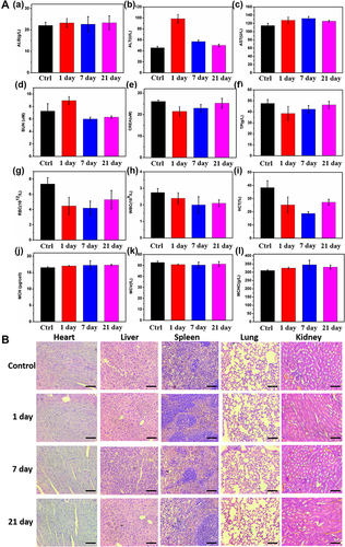 Figure 8 In vivo toxicity test of Mn-MoS2 QDs: (A(a–l)) Mouse serum biochemistry analysis and blood routine analysis before (0d, control) and after injection of Mn-MoS2 QDs for 1, 7, 21d. (B) Histological images of the heart, lungs, liver, spleen and kidneys of mice 1, 7 and 21 days post-intravenous injection of Mn-MoS2 QDs and in control mice. The organs were sectioned and stained with hematoxylin and eosin (H&E) and observed under a light microscope, scale bar = 100 μm.