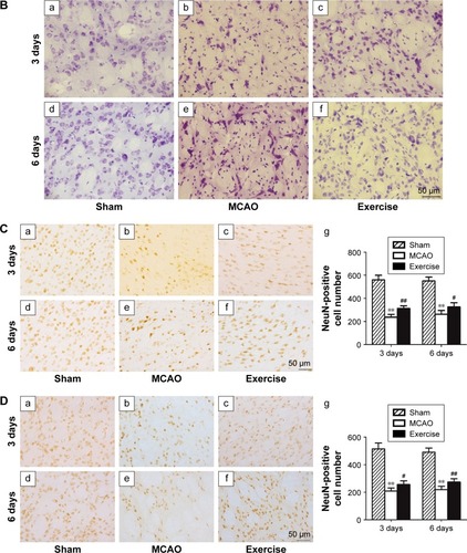 Figure 3 Exercise prevented neuronal cell death in rat model of ischemic brain injury.