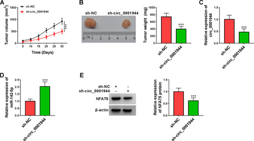 Figure 8 Circ_0001944 silencing curbed xenograft tumor growth in vivo. (A) Tumor growth curves were plotted using xenograft tumor volume data. (B) Tumor weight was assessed after tumor excision. (C and D) Expression tendencies of circ_0001944 and miR-142-5p in xenograft tumors were analyzed by qRT-PCR. (E) The level of NFAT5 protein in xenograft tumors was detected by Western blotting. ***P < 0.001.