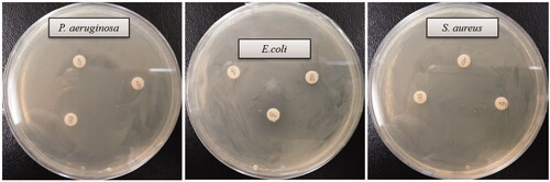 Figure 8. Zones of inhibition of commercial antibiotics against P. aeruginosa, E. coli and S. aureus. Abbreviation. E (erythromycin, 15 μg/disc), P (penicillin, G 10 μg/disc) and VA (vancomycin, 30 μg/disc).