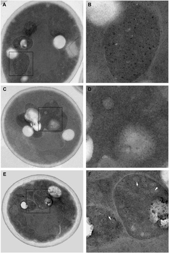 Figure 2 Transmission electron microscopy images of yeast cells (left) and their vacuoles (right), enlarged from left-hand box at 16 hours.Notes: The control cells (A) and (B), G-CdTe QDs treated cells (C) and (D) and O-CdTe QDs treated cells (E) and (F) were observed by transmission electron microscope (×7,800 magnification). White arrows: autophagic bodies.Abbreviations: CdTe QDs, cadmium telluride quantum dots; G-CdTe, green-emitting CdTe; O-CdTe, orange-emitting CdTe.