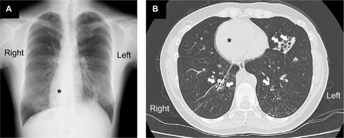 Figure 1 The radiographic findings.