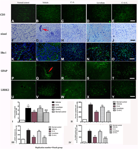 Figure 4 (A–J) CD3 and Nissel immunostaining. (A–E) CD3 immunostaining (green); (F–J) Nissel staining. (A and F) control; (B and G) MPTP, arrow in G denoted “perivascular cuffing” of inflammatory cells infiltration. (C and H) MPTP and C16+Ang-1; (D and I) MPTP and levodopa; (E and J) MPTP and C+A+L; (K–O) C16+Ang-1 treatment suppressed activated astrocytes as indicated by Iba-1 immunostaining. Iba-1 immunostaining (green) in the corpus striatum is shown. (K) control; (L) MPTP; (M) MPTP and C16+Ang-1; (N) MPTP and levodopa; (O) MPTP and C+A+L; (P–T): C16+Ang-1 suppressed activated astrocytes as indicated by GFAP immunostaining. (P) control; (Q) MPTP, arrow showed the reactive astrogliosis forms glia scar; (R) MPTP and C16+Ang-1; (S) MPTP and levodopa; (T) MPTP and C+A+L; (U–Y) Detection of LRRK2 using immunofluorescence. IRRK2 (green) in the corpus striatum is shown. (U) control; (V) MPTP; (W) MPTP and C16+Ang-1; (X) MPTP and levodopa; (Y) MPTP and C+A+L; (I–IV): Quantification of inflammatory scores (I), Iba-1+ cells (II), GFAP+ cells (III) and IRRK2+ cells (IV). a, P < 0.05 versus control; b, P < 0.05 versus vehicle group; c, P < 0.05 versus C16+Ang-1 treated group; d, P < 0.05 versus levodopa-treated group. Inflammatory scores:0, without inflammation; 1, limited cellular infiltration around blood vessels and meninges; 2, mild infiltration (1–10 inflammatory cells/slide in parenchymal tissues); 3, moderate infiltration (11–100 inflammatory cells/slide in parenchymal tissues); 4, severe infiltration (> 100 inflammatory cells/slide in parenchymal tissues).