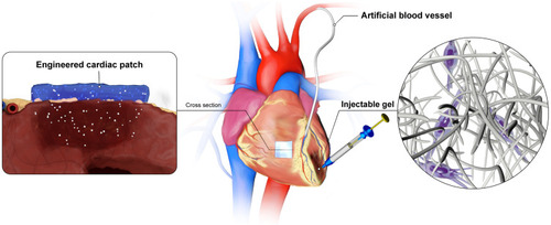 Figure 11 A schematic illustration of a typical cardiac tissue engineering scaffold based on natural and synthesis polymers.