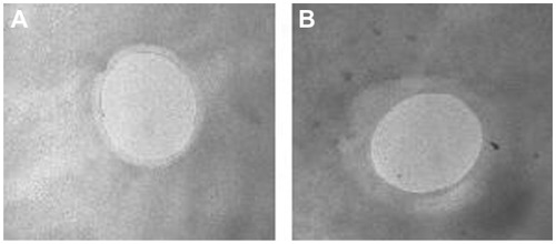 Figure 2 Transmission electron microscopy image of (A) unloaded and (B) DNA-loaded chitosan nanobubbles.