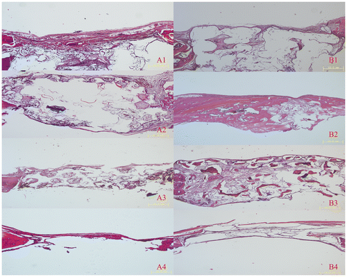 Figure 7. HE images of implanted and control group after four and eight weeks. (A) Histological images of implanted (1) PLA/HA, (2) β-TCP and (3) DBM scaffolds as well as (4) control group four weeks after implantation. (B) Histological images of (1) implanted PLA/HA, (2) β-TCP and (3) DBM scaffolds as well as (4) control group eight weeks after implantation. Scale bars 10 μm.