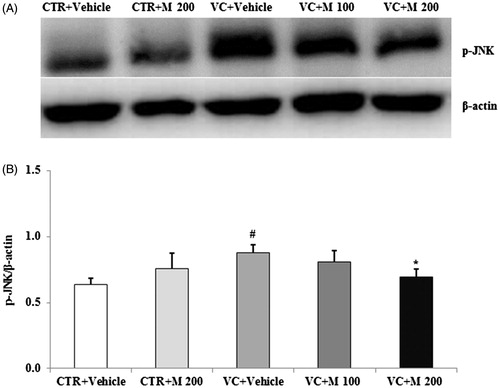 Figure 5. Effects of MOTILIPERM on the level of p-JNK protein in the varicocele-induced endoplasmic reticulum stress response. (A) Western blot of testis. (B) Level of p-JNK protein for each group. Beta-actin used as a loading control to normalize the p-JNK protein levels in each sample. p-JNK: phosphorylated c-Jun-N-terminal kinase; CTR + vehicle: normal control group; CTR + M 200: normal rats administered 200 mg/kg MOTILIPERM; VC + vehicle: varicocele-induced rats; VC + M 100: varicocele-induced rats administered 100 mg/kg MOTILIPERM; VC + M 200: varicocele-induced rats administered 200 mg/kg MOTILIPERM. #Significantly different from CTR + vehicle group (p < 0.05). *Significantly different from VC + vehicle group (p < 0.05).
