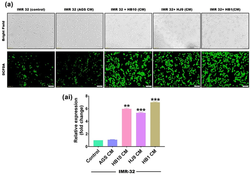 Figure 4. H. pylori-derived secretome prompts the oxidative stress in neuroblastoma cells. The first row represents a bright field image, and the second row represents the fluorescence microscopy image showing the total cellular ROS upon exposure with HPCM to (a) IMR-32 cells for 12 hrs. Meanwhile, we determined the significantly enhanced cellular ROS production quantified through image J software and represented in fold change. The experiment was performed for two biological and two technical replicates (four data points), and the results are shown as the mean ± SD for three data points. An unpaired t-test was used to analyse the data. p < 0.05 was considered significant in all the cases. p-values of < 0.05, < 0.01 and < 0.0001 were represented with *, ** and *** respectively for significant upregulation and #, ##, and ### for significant downregulation.