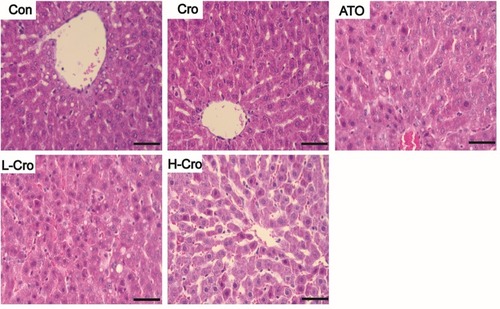 Figure 2 Effects of crocetin on hepatic histopathologic changes in ATO-treated rats. Scale bar = 50 µm (hematoxylin and eosin, 400×).