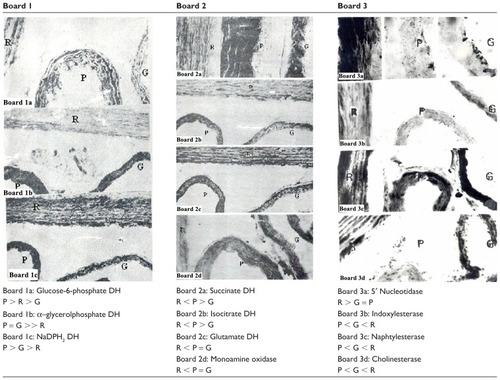 Figure 1 Interspecies differences of aortic enzymes of Psammomys, Gerbillus gerbillus, and Wistar rats.