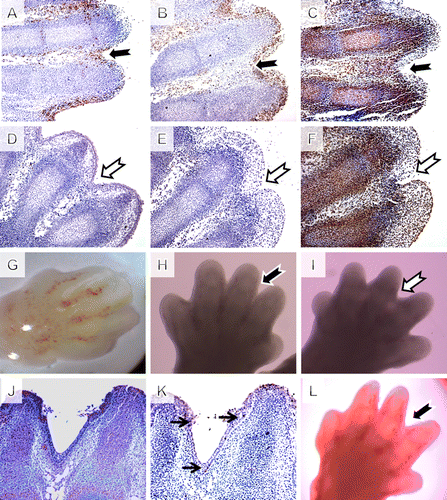 Figure 3.  Pharmacological inhibition of caspase-3 in mouse limb explant cultures. (A–C) control group, (D–F) inhibited group, magnification 200×. (A and D) Caspase-3 activation in serial sections after 24 hours of cultivation based on IHC shows no active caspase-3 in the inhibited samples. (B and E) TUNEL assay in serial sections after 24 hours of cultivation shows dramatic reduction of apoptosis in the inhibited samples. (C and F) Comparable growth of the explants cultures checked using PCNA immunohistochemistry (IHC). (G) Macroscopic view on the cultivation starting point stage limb. (H) Control limb after 48 hours of cultivation with loss of the interdigit tissue. (I) Caspase-3-inhibited explant showing interdigital webbing. (J) Caspase-3 was negative after 72 h of cultivation but (K) TUNEL positive cells reappeared and (L) digit separation continued.