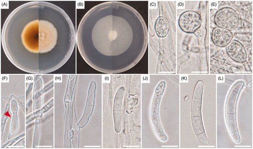 Figure 3. Cultural and morphological characteristics of UD ST 1-2-1. (A) Colonies on potato dextrose agar (PDA); (B) Colonies on synthetic nutrient agar (SNA) for 14 days of incubation at 25 °C; (C–E) Chlamydospores; (F) Phialidic cell; (G) Conidiophore; (H) Conidiogenous cell; (I–L) Macroconidia. Arrows indicate phialidic cells. Scale bars: C–L = 10 μm.