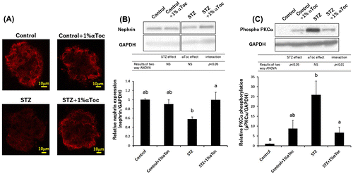 Figure 3. Effects of the oral administration of αToc on podocyte loss and the phosphorylation of PKCα in DN. The kidneys of the mice were removed at the end of the experiment (week 6) and were sectioned. We performed immunofluorescent staining of these sections using an anti-nephrin antibody for the primary antibody. The nephrin staining (red) was observed using confocal laser microscopy (A). The kidneys removed at the end of experiment (week 6) were lysed and subjected to SDS-PAGE followed by Western blotting using anti-nephrin antibody (B) and anti-PKCα (phospho S657) antibody (C). The intensities of nephrin and phospho-PKCα were analyzed with ImageJ and normalized to that of GAPDH. The values are means ± SE. The results of two way ANOVA were shown as a table in graphs. Different superscript letters indicate significant difference analyzed with two way ANOVA and Scheffe’s test among the groups.