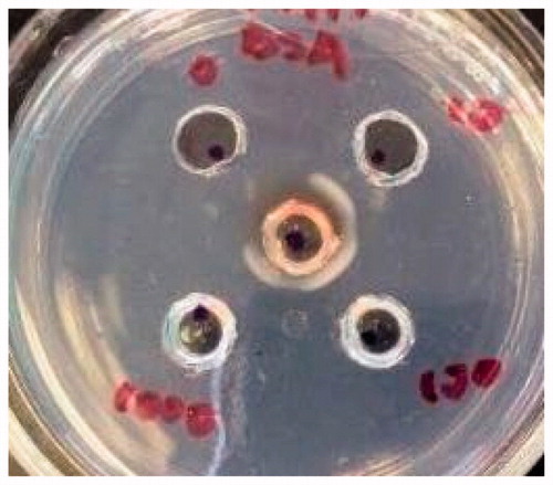 Figure 5. Ouchterlony double diffusion test. Positive control of BSA showing BSA and anti-BSA antibody precipitation.