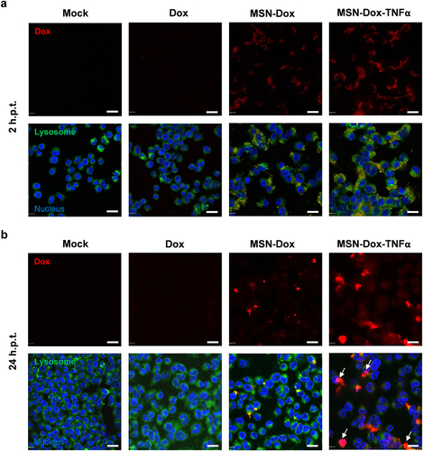 Figure 2 In vitro cellular uptake of free Dox, MSN-Dox, or MSN-Dox-TNFα at various time points were visualized by confocal microscopy in MES-SA/Dx5 cells incubation time (a) 2 h and (b) 24 h with 50 μg/mL NP or 0.4 μg/mL Dox. Dox showed red fluorescence. Lysosomes stained with lysotracker green probe. Nucleus was stained by DAPI. Note the higher level of MSN-Dox-TNFα uptake, and the colocalization of the MSN within the lysosomes. Colocalization of Dox within the nucleus (indicated by white arrow) after 24 h post-treatment. Scale bars: 20 μm.