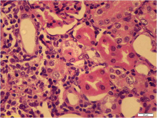 Figure 3. Kidney for rats receiving Spirulina. High magnification showing tubules of the OSOM with intact architecture, no degenerative or regenerative changes.