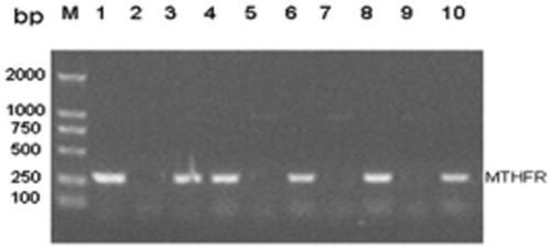 Figure 1. MTHFR genotype analysis electrophoresis map. 1–2: CC genotype; 3–4: CT genotype; 5–10: TT genotype; M: DNA Marker DL2000.