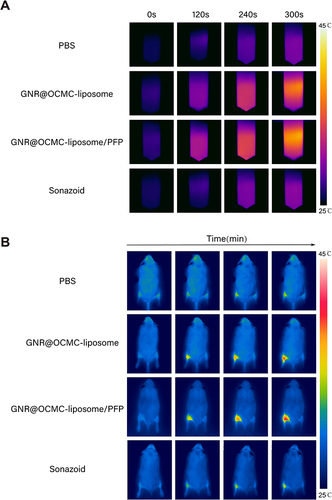 Figure 5 Photothermal imaging capability of the GNR@OCMC-liposome/PFP. (A) Photothermal images of PBS, GNR@OCMC-liposome, GNR@OCMC-liposome/PFP and Sonazoid groups under NIR irradiation (760 nm, 1.0 W/cm2); (B) Photothermal images of the left hindlimb of mice after tail vein injection of PBS, GNR@OCMC-liposome, GNR@OCMC-liposome/PFP and Sonazoid irradiated by the NIR laser over time.