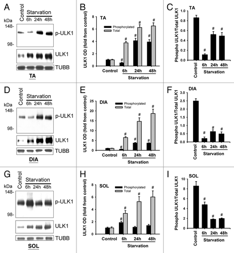 Figure 9. ULK1 expression and phosphorylation in response to starvation. (A, D, and G) Representative immunoblots of total and phosphorylated (Ser555) ULK1 in TA, DIA, and SOL muscles of control animals and those who underwent starvation for 6, 24, or 48 h. (B, E, and H) Protein optical densities of total and phosphorylated ULK1 in TA, DIA, and SOL muscles of control and acutely starved mice. Values (means ± SEM) are expressed as fold change relative to control group. #P < 0.05, as compared with control. n = 4 per group. (C, F, and I) Ratios of optical densities of phosphorylated and total ULK1 proteins in TA, DIA, and SOL muscles of control and acutely starved mice. Values are means ± SEM #P < 0.05, as compared with control. n = 4 per group.