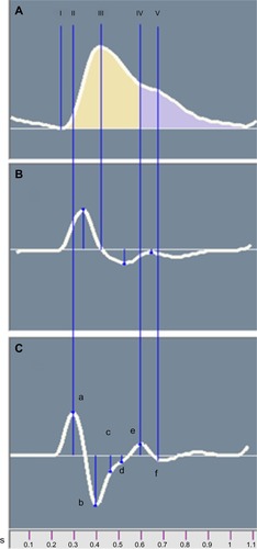 Figure 2 Averaged photoplethysmograph wave (A) and its first (B) and second (C) derivatives.